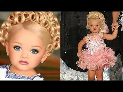 Remember that little girl who looked like a doll? This is how her life turned out...