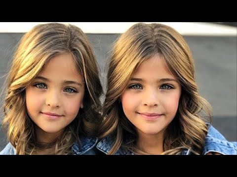In 2017 they were called the most beautiful twins in the world! This is how their life turned out...
